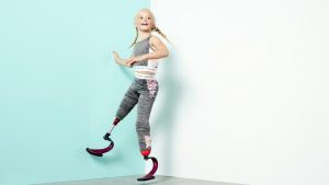 Daisy-May Demetre: le gambe amputate non le impediscono di sfilare