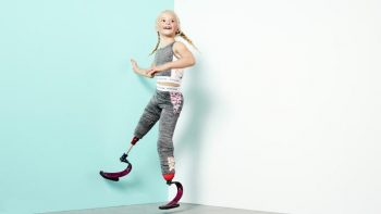 Daisy-May Demetre: le gambe amputate non le impediscono di sfilare