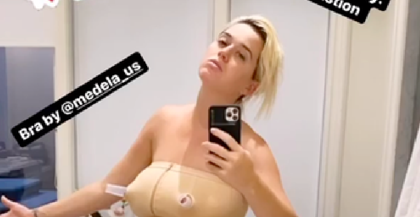 Katy Perry, Ashley Graham, Beatrice Valli. I corpi delle donne dopo il parto: belle da impazzire
