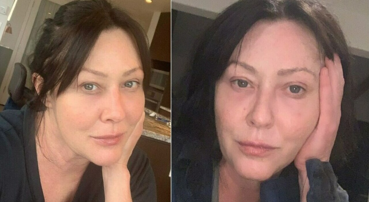 Shannen Doherty cancro