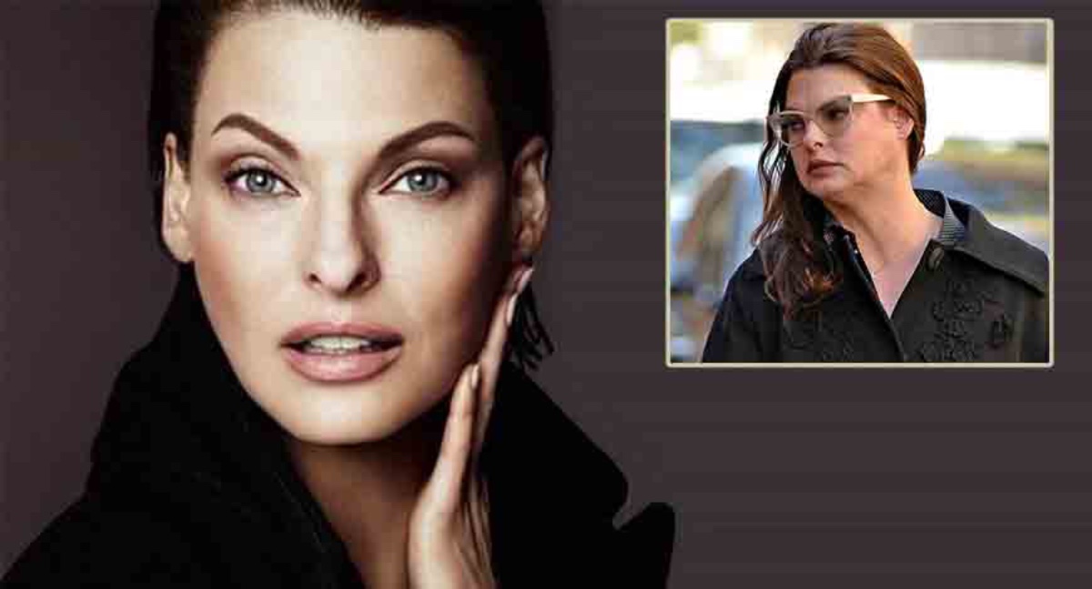 Linda Evangelista chirurgia 