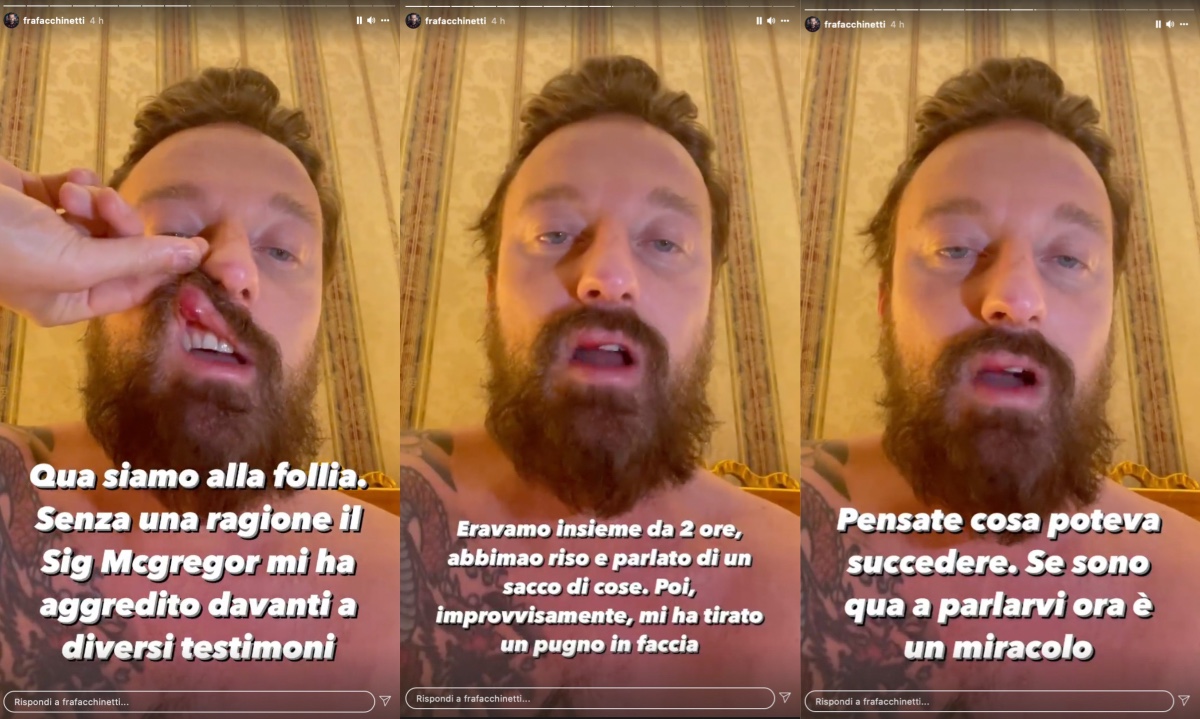 Benji Conor McGregor Facchinetti 