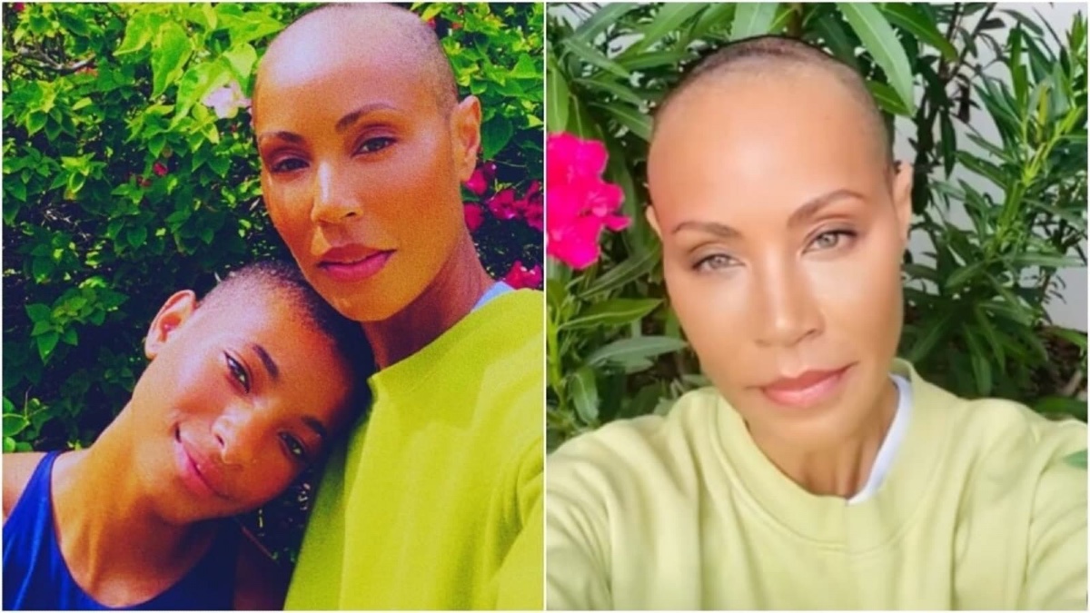 Jada Smith alopecia 