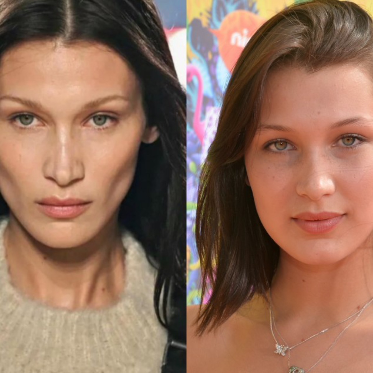 rinoplastica Bella Hadid 