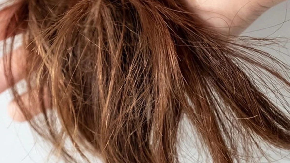 Doppie punte: i segreti per prevenire e curare